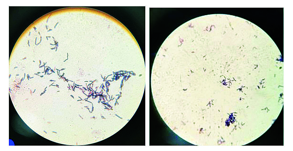 ဆောင်းပါး